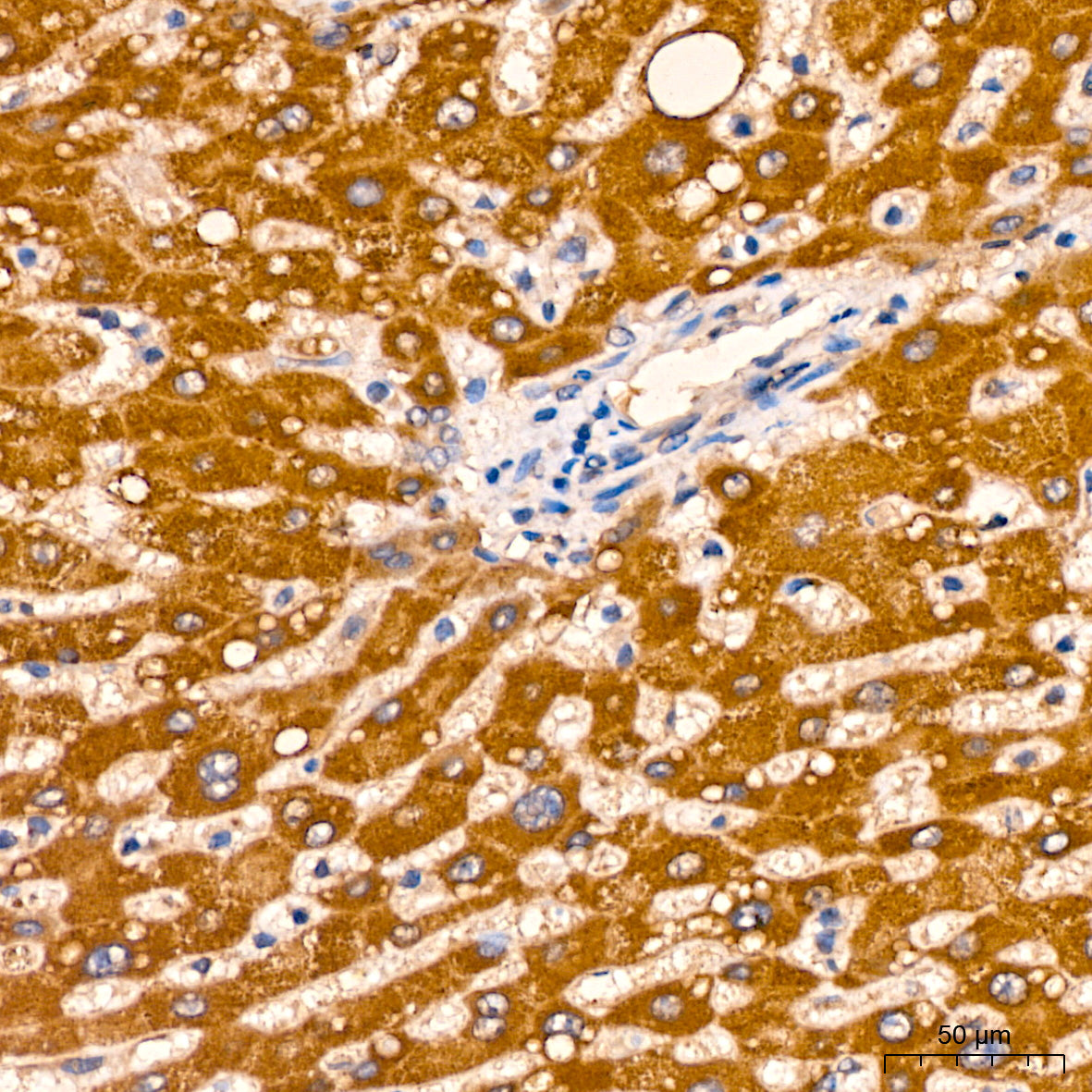 AGMAT Rabbit mAb