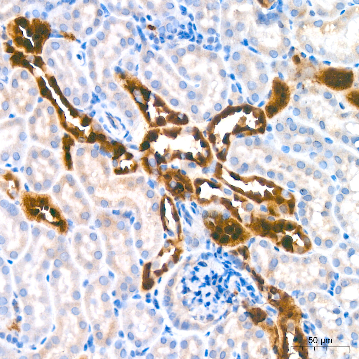 AGMAT Rabbit mAb