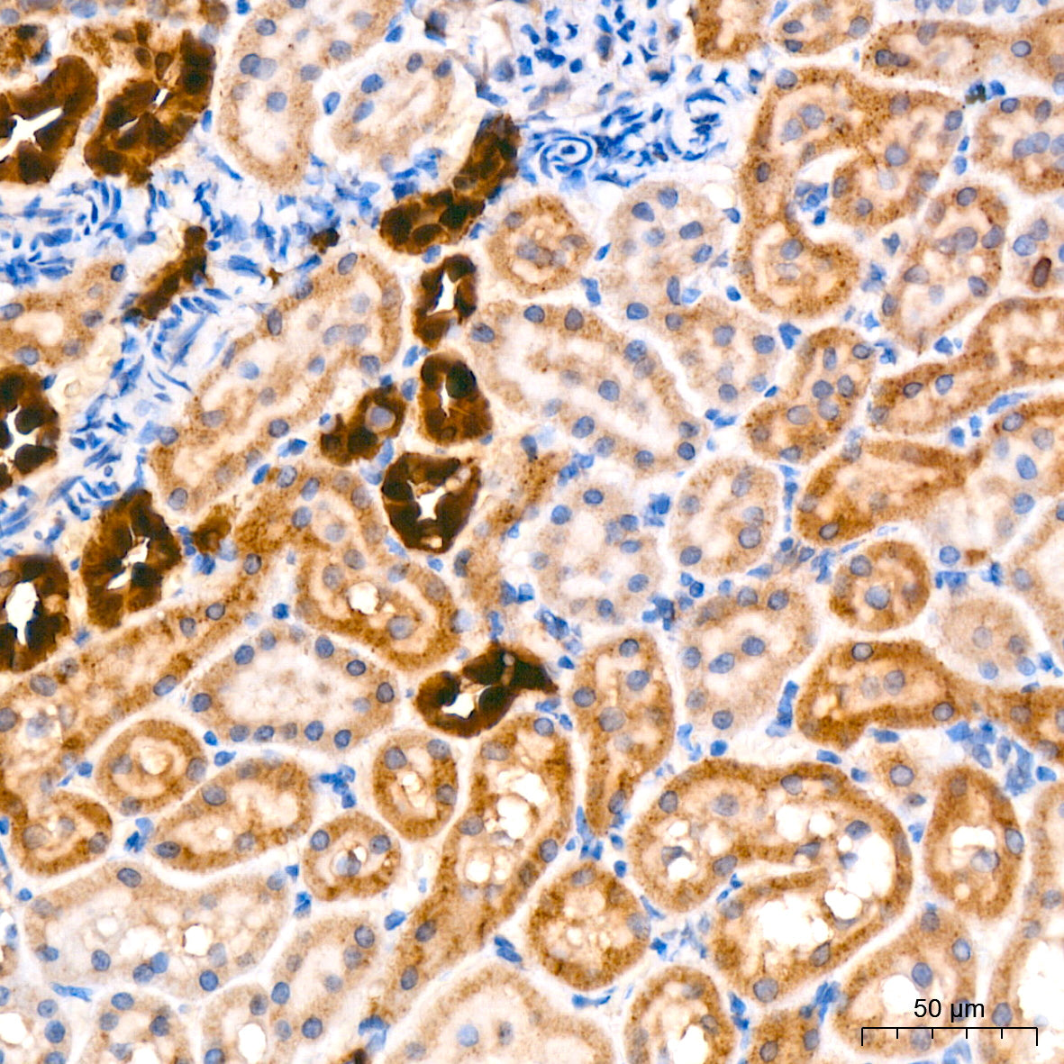 AGMAT Rabbit mAb