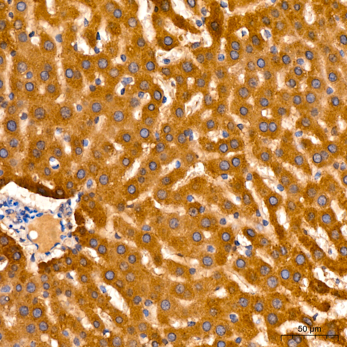 AGMAT Rabbit mAb