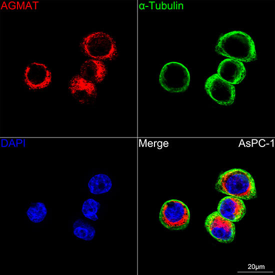 AGMAT Rabbit mAb