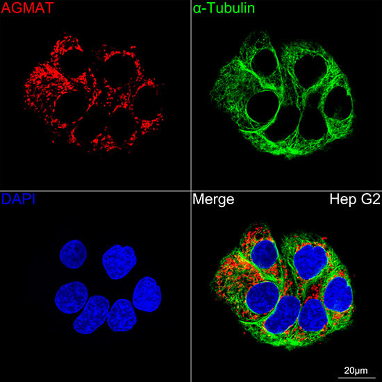 AGMAT Rabbit mAb