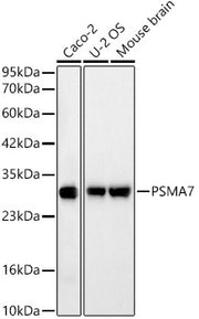 [KD Validated] PSMA7 Rabbit mAb
