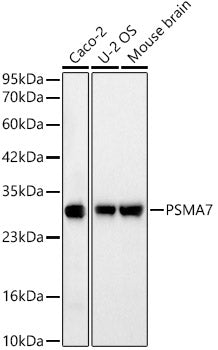 [KD Validated] PSMA7 Rabbit mAb