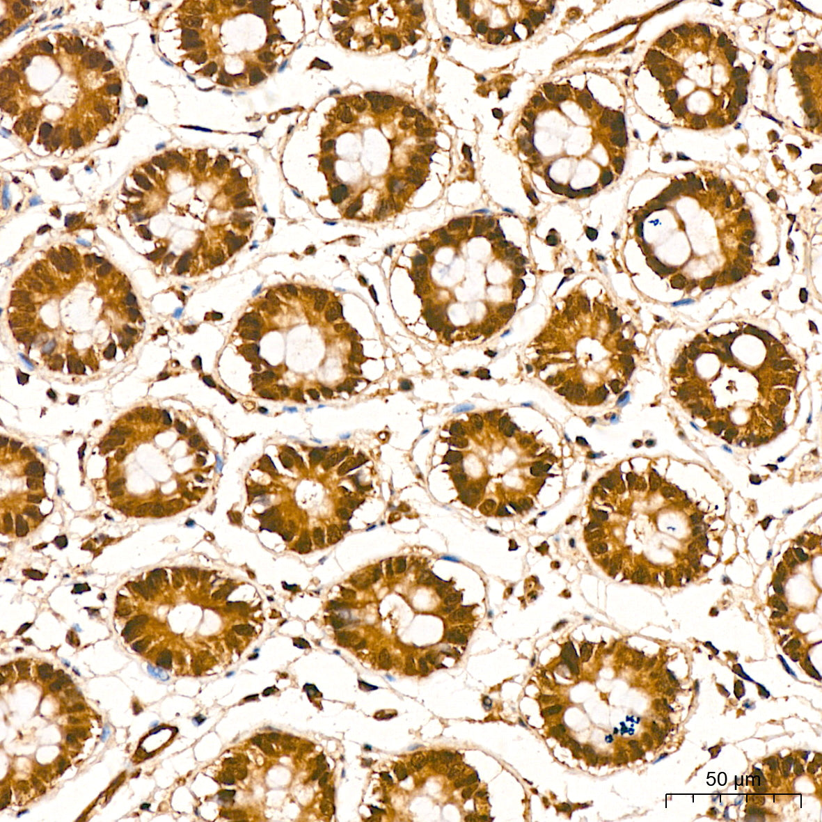 [KD Validated] PSMA7 Rabbit mAb