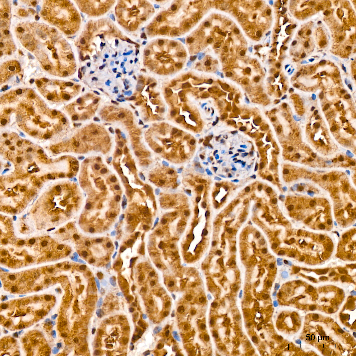 [KD Validated] PSMA7 Rabbit mAb