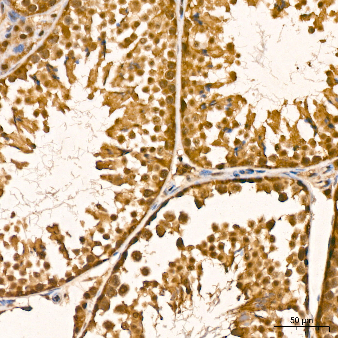 [KD Validated] PSMA7 Rabbit mAb
