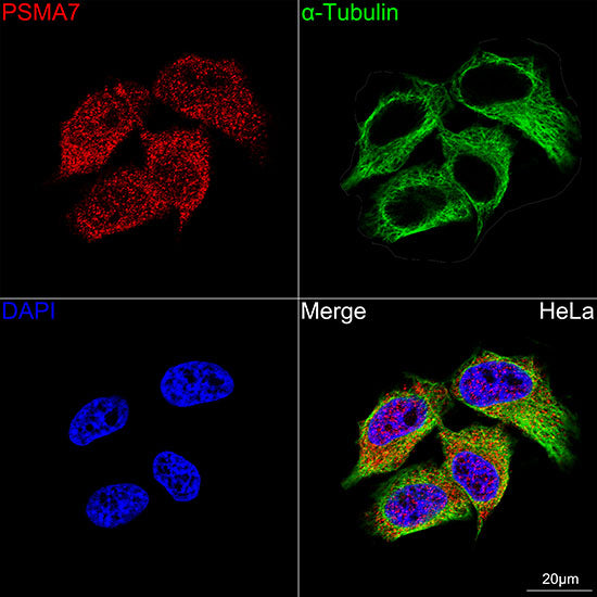 [KD Validated] PSMA7 Rabbit mAb