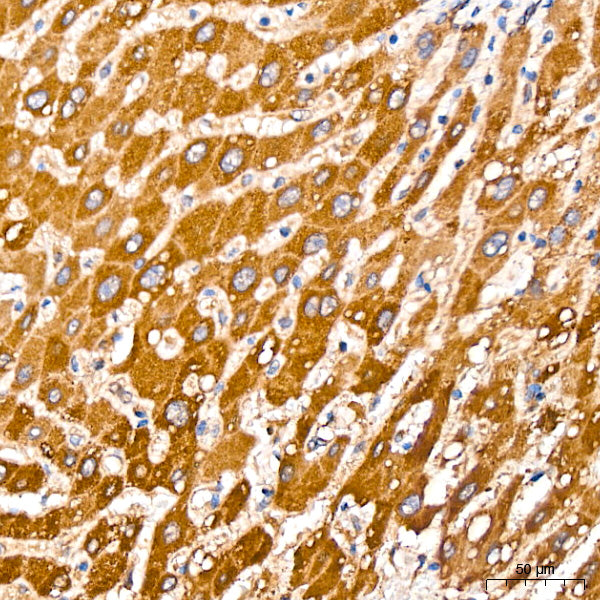 [KO Validated] PCCB Rabbit mAb