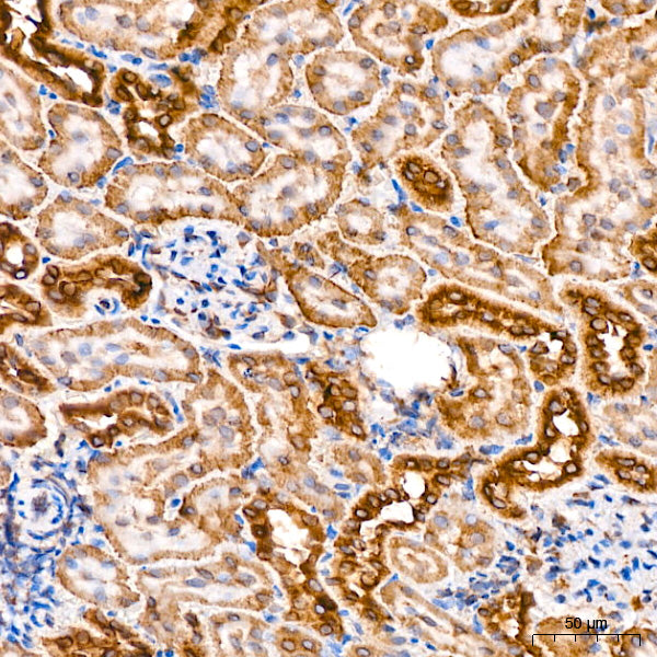 [KO Validated] PCCB Rabbit mAb