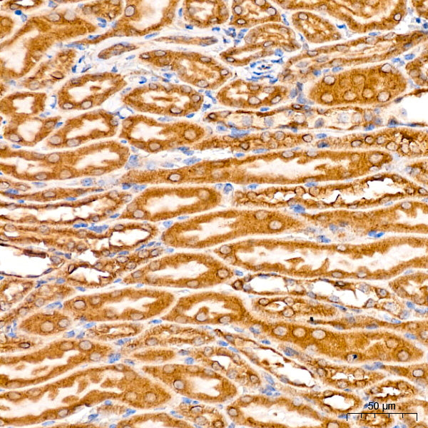 [KO Validated] PCCB Rabbit mAb
