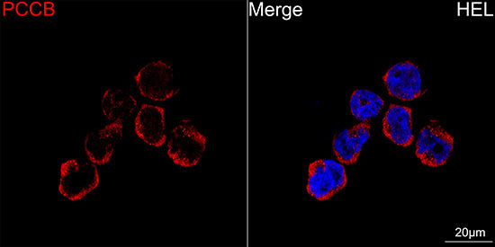 [KO Validated] PCCB Rabbit mAb