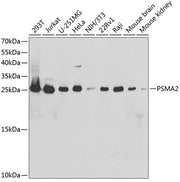 PSMA2 Rabbit pAb