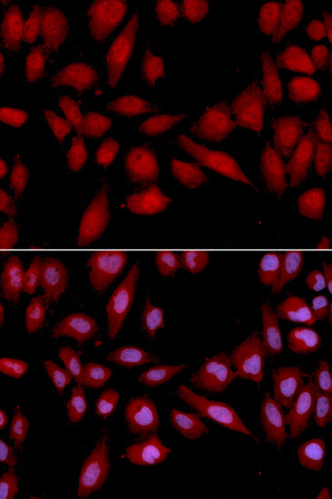 PSMA2 Rabbit pAb