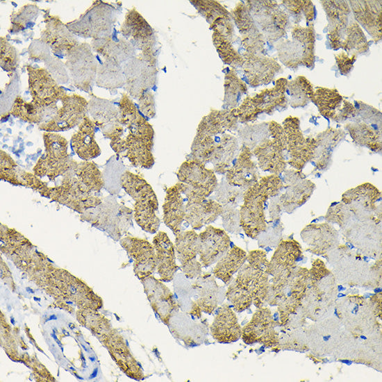 HSPB8/HSP22 Rabbit pAb