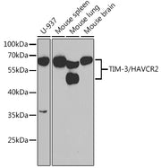 TIM-3/HAVCR2 Rabbit pAb