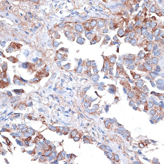 TIM-3/HAVCR2 Rabbit pAb