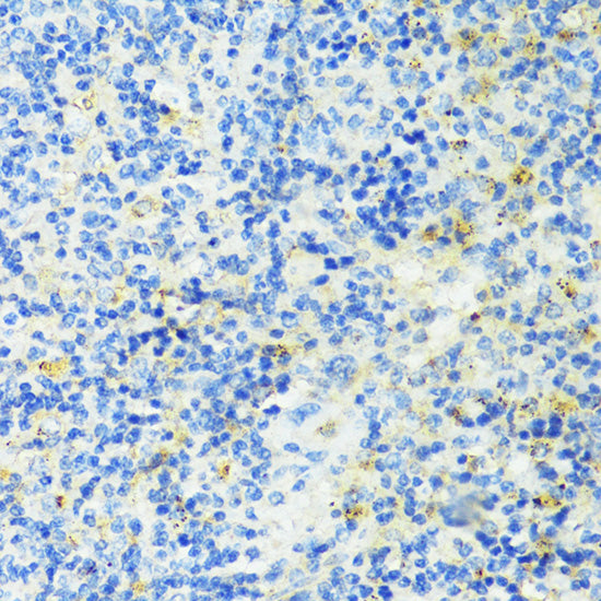 TIM-3/HAVCR2 Rabbit pAb
