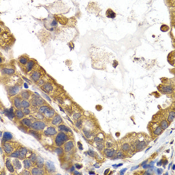 Glycogen synthase 1 (GYS1) Rabbit pAb