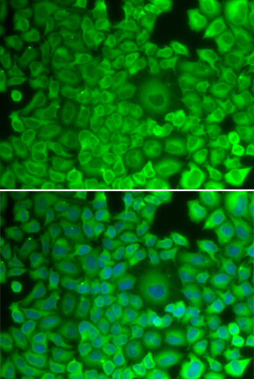 Glycogen synthase 1 (GYS1) Rabbit pAb
