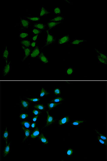 PSMA1 Rabbit pAb