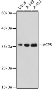 ACP5 Rabbit pAb