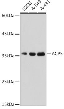 ACP5 Rabbit pAb