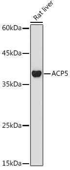 ACP5 Rabbit pAb