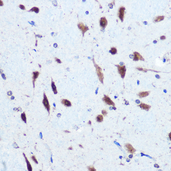 hnRNP E2/PCBP2 Rabbit pAb