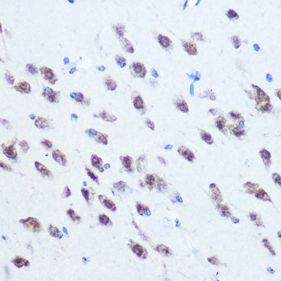 hnRNP E2/PCBP2 Rabbit pAb