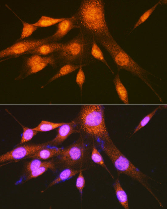 hnRNP E2/PCBP2 Rabbit pAb