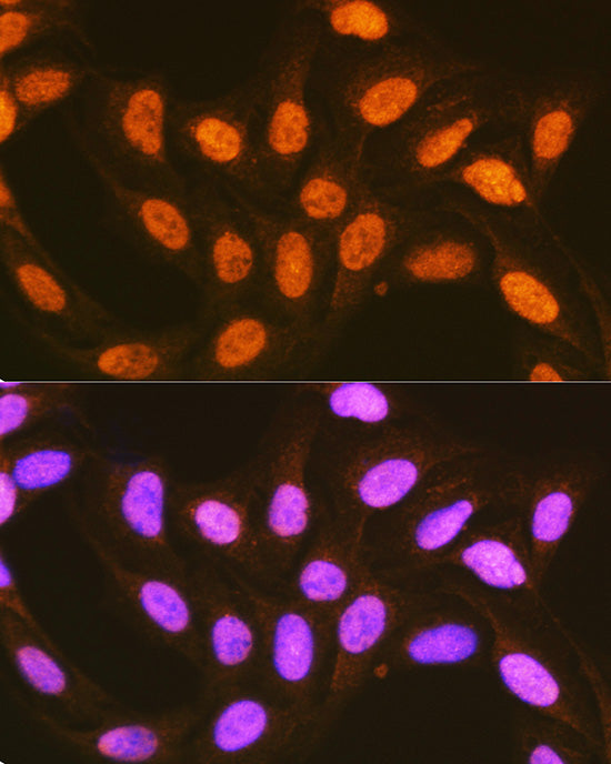 hnRNP E2/PCBP2 Rabbit pAb