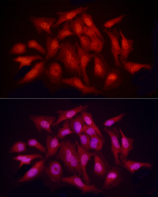 hnRNP E2/PCBP2 Rabbit pAb