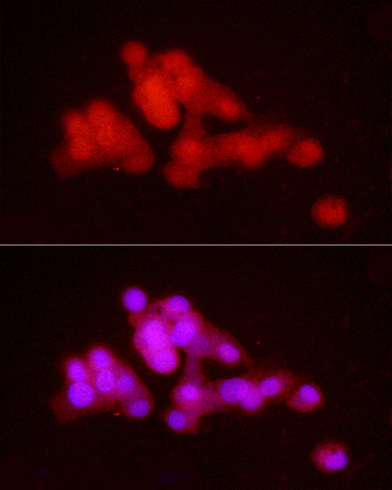 hnRNP E2/PCBP2 Rabbit pAb