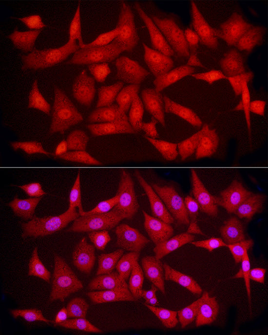 hnRNP E2/PCBP2 Rabbit pAb