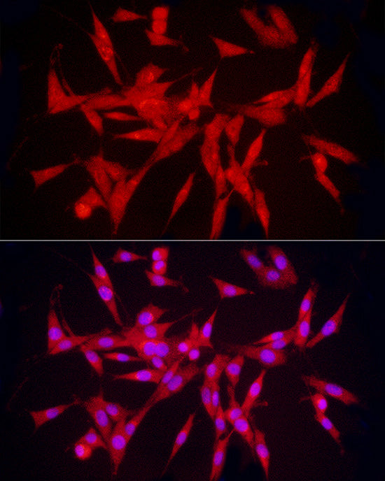 hnRNP E2/PCBP2 Rabbit pAb