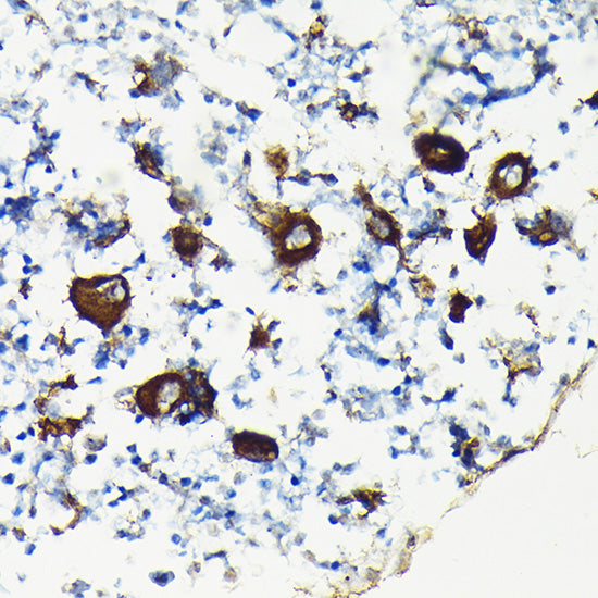 Integrin beta 3 (ITGB3/CD61) Rabbit pAb