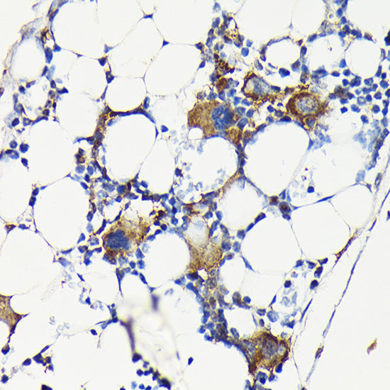 Integrin beta 3 (ITGB3/CD61) Rabbit pAb
