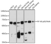 NF-kB p65/RelA Rabbit pAb