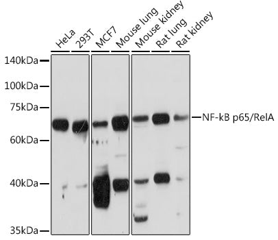 NF-kB p65/RelA Rabbit pAb