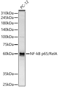 NF-kB p65/RelA Rabbit pAb