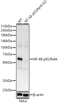 NF-kB p65/RelA Rabbit pAb