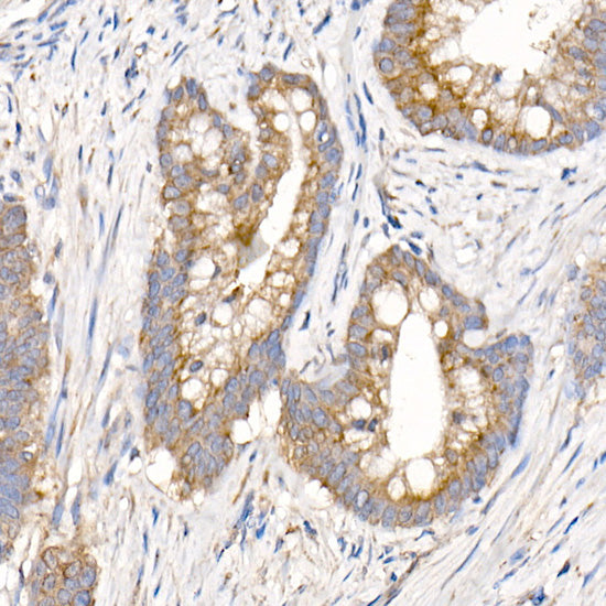 MMP14/MT1-MMP Rabbit pAb