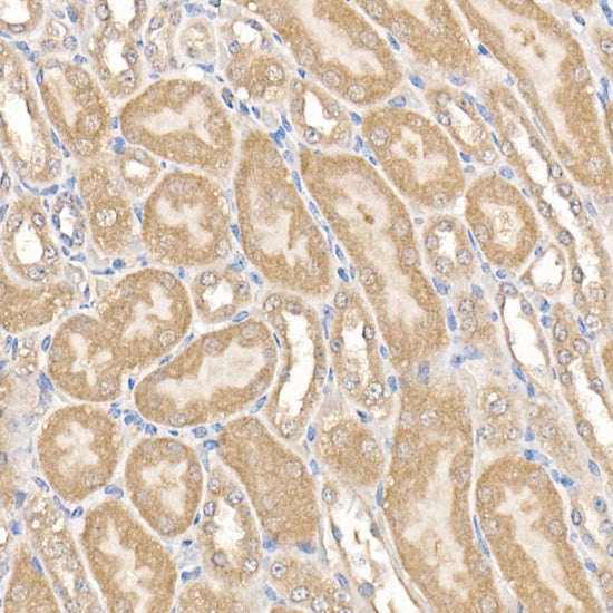 MMP14/MT1-MMP Rabbit pAb