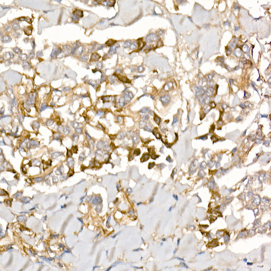 TGF beta induced (TGFBI) Rabbit pAb