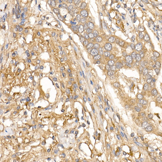 TGF beta induced (TGFBI) Rabbit pAb
