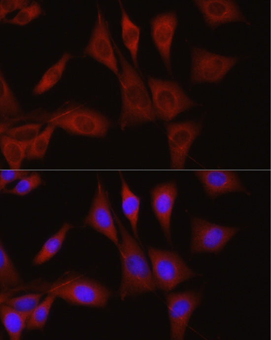 TGF beta induced (TGFBI) Rabbit pAb