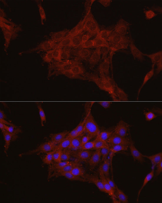 TGF beta induced (TGFBI) Rabbit pAb