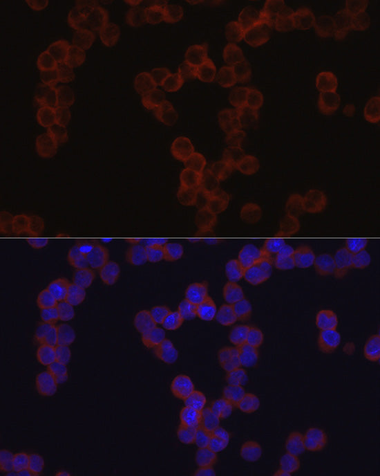 TGF beta induced (TGFBI) Rabbit pAb