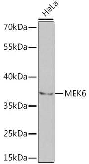 MEK6 Rabbit pAb